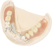 部分入れ歯