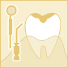 むし歯、歯周病などの治療
