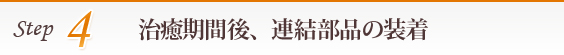 4.治癒期間後、連結部品の装着