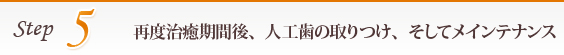 5.再度治癒期間後、人工歯の取りつけ、そしてメインテナンス